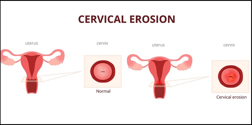 Best Infertility Treatment Specialist in Pune
